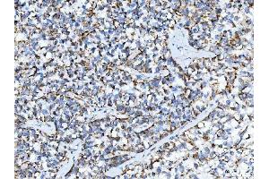 IHC analysis of TRK fused gene/TFG using anti-TRK fused gene/TFG antibody (ABIN7599839). (TFG 抗体  (AA 121-400))