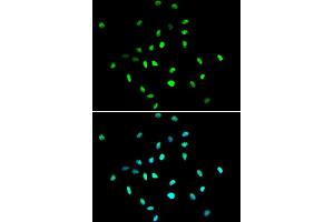 Immunofluorescence analysis of A549 cell using HDAC1 antibody. (HDAC1 抗体  (AA 393-482))