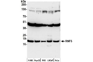 anti-Ring Finger Protein 5, E3 Ubiquitin Protein Ligase (RNF5) (AA 1-50) antibody