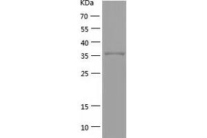 Western Blotting (WB) image for Tumor Necrosis Factor Receptor Superfamily, Member 8 (TNFRSF8) (AA 19-379) protein (His tag) (ABIN7125556)
