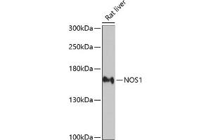 Western blot analysis of extracts of rat liver, using NOS1 antibody (ABIN3022008, ABIN3022009, ABIN3022010 and ABIN6218566) at 1:2000 dilution. (NOS1 抗体  (AA 1-180))