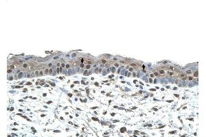 CENPA antibody was used for immunohistochemistry at a concentration of 4-8 ug/ml to stain Squamous epithelial cells (arrows) in Human Skin. (CENPA 抗体  (N-Term))