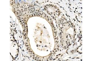 IHC analysis of JUNB using anti-JUNB antibody (ABIN7603223). (JunB 抗体  (N-Term))