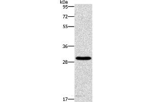 Western blot analysis of Hela cell, using BCL10 Polyclonal Antibody at dilution of 1:950 (BCL10 抗体)