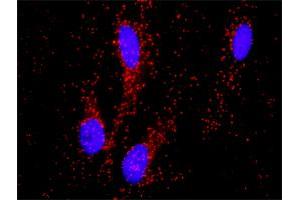 Proximity Ligation Analysis of protein-protein interactions between PITX2 and CTNNB1. (PITX2 抗体  (AA 1-271))