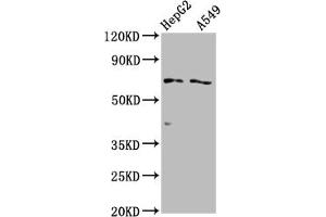 Western Blot Positive WB detected in: HepG2 whole cell lysate, A549 whole cell lysate All lanes: SLCO1B1 antibody at 1:2000 Secondary Goat polyclonal to rabbit IgG at 1/50000 dilution Predicted band size: 77 kDa Observed band size: 77 kDa (SLCO1B1 抗体  (AA 426-537))