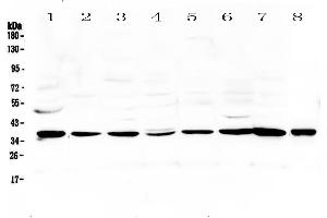Western blot analysis of Thrombopoietin using anti-Thrombopoietin antibody . (Thrombopoietin 抗体  (AA 27-259))