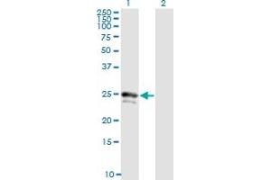 Western Blot analysis of FGF21 expression in transfected 293T cell line by FGF21 monoclonal antibody (M02), clone 1A8.