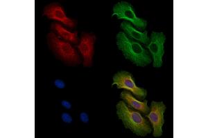 ABIN6256556 and ABIN6267493 staining H2O2 treated Hela cells by IF/ICC.