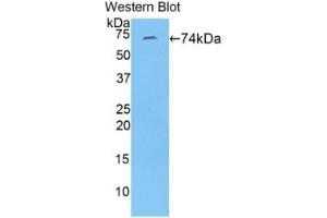 WB of Protein Standard: different control antibodies against Highly purified E. (FBLN4 ELISA 试剂盒)
