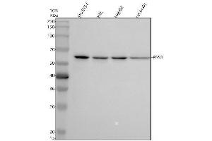 Western blot analysis of PGS1 using anti-PGS1 antibody (ABIN7825679).