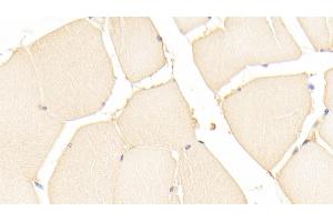Detection of PARK7 in Human Skeletal muscle Tissue using Polyclonal Antibody to Parkinson Disease Protein 7 (PARK7)