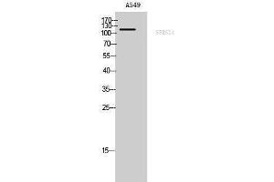 Western Blotting (WB) image for anti-Splicing Factor, Arginine/serine-Rich 14 (SFRS14) (Internal Region) antibody (ABIN3186925)