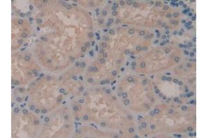 DAB staining on IHC-P; Samples: Human Kidney Tissue (ADCY7 抗体  (AA 806-1052))