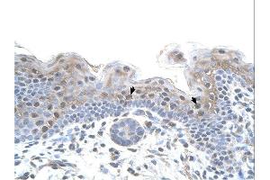 STRAP antibody was used for immunohistochemistry at a concentration of 4-8 ug/ml. (STRAP 抗体  (N-Term))