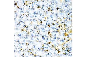 Immunohistochemistry of paraffin-embedded mouse kidney using TAPBP Antibody (ABIN6132745, ABIN6148848, ABIN6148850 and ABIN6219122) at dilution of 1:200 (40x lens). (TAPBP 抗体  (AA 30-260))
