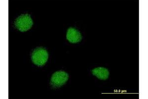 Immunofluorescence of monoclonal antibody to SSX4 on HeLa cell. (SSX4 抗体  (AA 91-188))