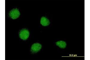 Immunofluorescence of monoclonal antibody to SSX4 on HeLa cell.