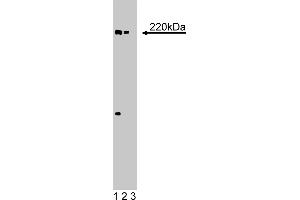 Western Blotting (WB) image for anti-eIF-4gamma (AA 1217-1386) antibody (ABIN968023) (eIF-4gamma (AA 1217-1386) 抗体)