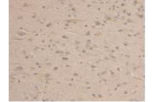 Immunohistochemistry (IHC) image for anti-Glyceraldehyde-3-Phosphate Dehydrogenase (GAPDH) (AA 154-324) antibody (ABIN7438157)