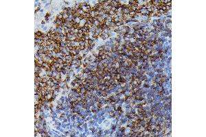 Immunohistochemistry of paraffin-embedded rat spleen using Apolipoprotein C3 antibody (ABIN7265641) at dilution of 1:100 (40x lens). (APOC3 抗体  (AA 1-99))