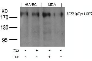 Image no. 1 for anti-Epidermal Growth Factor Receptor (EGFR) (pTyr1197) antibody (ABIN401613) (EGFR 抗体  (pTyr1197))
