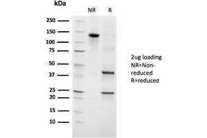 SDS-PAGE Analysis Purified Growth Hormone Mouse Monoclonal Antibody (GH/3155). (Growth Hormone 1 抗体)