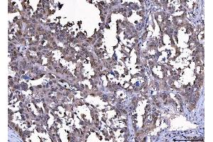 IHC analysis of Cdk2 using anti-Cdk2 antibody (ABIN7602523).