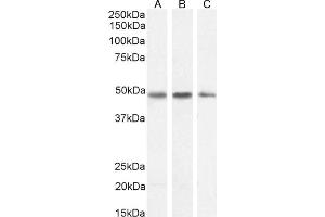 Western Blotting (WB) image for anti-serpin Peptidase Inhibitor, Clade I (neuroserpin), Member 1 (SERPINI1) (C-Term) antibody (ABIN185373)