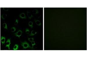 Immunofluorescence analysis of HuvEc cells, using RPS4X Antibody. (RPS4X 抗体  (AA 81-130))