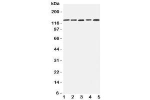Western blot testing of Integrin alpha 7 antibody and Lane 1:  293T (ITGA7 抗体  (C-Term))