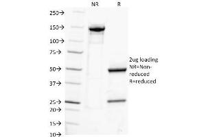 SDS-PAGE Analysis Purified IgG Monoclonal Antibody (IG217). (IGHG 抗体)