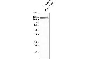 Western Blotting (WB) image for anti-mTurquoise Fluorescent Protein antibody (ABIN7273076) (mTurquoise Fluorescent Protein 抗体)