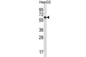 Western Blotting (WB) image for anti-TBC1 Domain Family, Member 22A (TBC1D22A) antibody (ABIN2996989)
