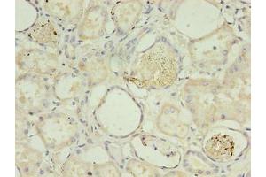 Immunohistochemistry of paraffin-embedded human kidney tissue using ABIN7142054 at dilution of 1:100 (PLCD4 抗体  (AA 1-762))