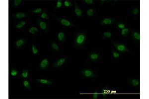 Immunofluorescence of monoclonal antibody to SFPQ on HeLa cell. (SFPQ 抗体  (AA 269-361))