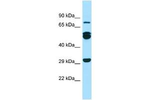 Western Blotting (WB) image for anti-Rab11 Family-Interacting Protein 1 (RAB11FIP1) (N-Term) antibody (ABIN2790054) (RAB11FIP1 抗体  (N-Term))