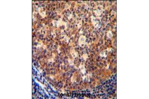 IL12B antibody immunohistochemistry analysis in formalin fixed and paraffin embedded human tonsil tissue followed by peroxidase conjugation of the secondary antibody and DAB staining. (IL12B 抗体  (C-Term))