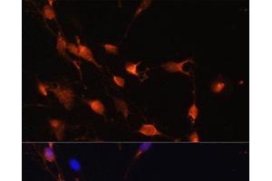 Immunofluorescence analysis of C6 cells using RAB11A Polyclonal Antibody at dilution of 1:100. (RAB11A 抗体)
