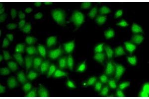 Immunofluorescence analysis of A-549 cells using WNT7A Polyclonal Antibody (WNT7A 抗体)