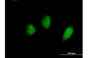 Immunofluorescence of purified MaxPab antibody to FKHL18 on HeLa cell. (FOXS1 抗体  (AA 1-330))