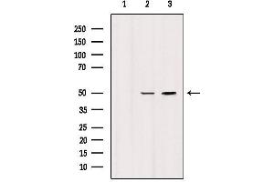 Western blot analysis of extracts from various samples, using HTR3D Antibody.
