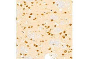 Immunohistochemistry (Paraffin-embedded Sections) (IHC (p)) image for anti-Hairy and Enhancer of Split 3 (HES3) antibody (ABIN7074159)