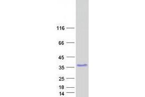 Western Blotting (WB) image for Zinc Finger Protein 146 (ZNF146) (Transcript Variant 1) protein (Myc-DYKDDDDK Tag) (ABIN2735924)