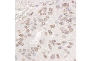 anti-DEAD (Asp-Glu-Ala-Asp) Box Polypeptide 17 (DDX17) (C-Term) antibody
