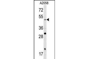 Western blot analysis of SOX4 antibody (N-term) (ABIN388786 and ABIN2839119) in  cell line lysates (35 μg/lane). (SOX4 抗体  (N-Term))
