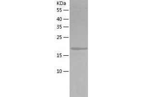 Western Blotting (WB) image for A Kinase (PRKA) Anchor Protein 13 (AKAP13) (AA 2-161) protein (His tag) (ABIN7287030) (AKAP13 Protein (AA 2-161) (His tag))