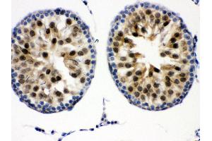Anti- Cdk2 Picoband antibody,IHC(P) IHC(P): Mouse Testis Tissue (CDK2 抗体  (AA 81-298))