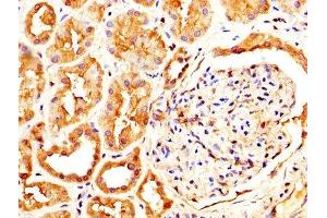 IHC image of ABIN7146077 diluted at 1:600 and staining in paraffin-embedded human kidney tissue performed on a Leica BondTM system. (CLEC4E 抗体  (AA 41-219))