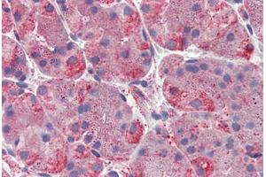 Human, Stomach: Formalin-Fixed Paraffin-Embedded (FFPE) (ERP44 抗体  (C-Term))